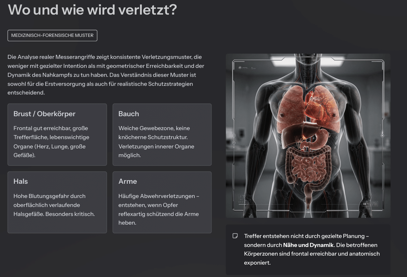 Grafik zu typischen Verletzungsmustern bei Messerangriffen am Körper – Brust, Bauch, Hals und Arme